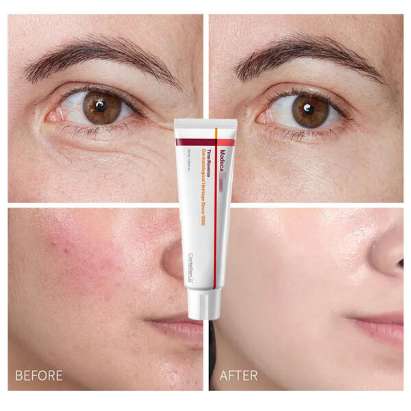 madeca cream time reverse | anti aging moisturizer for wrinkles & dry skin | cica + hyaluronic acid | korean skincare | 1.69 fl.oz