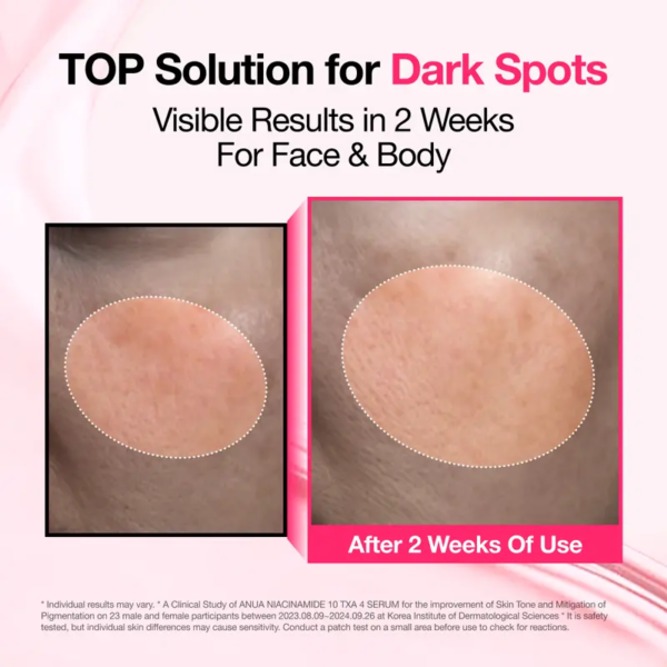 [anua] dark spot correcting serum : 10% niacinamide+ 4% tranexamic acid 1.01 fl.oz. (30ml) ｜ niacinamide serum, pm skincare product, hyperpigmentation, brightening